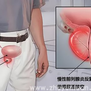 男性最害怕的前列腺炎，原来这样就能预防？